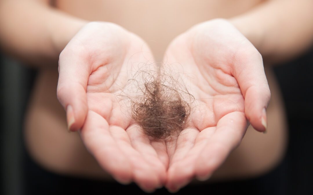 Diffuser Haarausfall