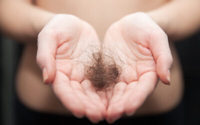 Was ist diffuser Haarausfall? Die Definition, die Klarheit schafft