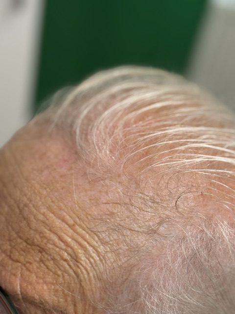Detaillierte Nahaufnahme der gealterten Stirn und der lichter werdenden, grauen Haare eines älteren Mannes, die nach hinten gekämmt sind, vor einem unscharfen grünen Hintergrund.